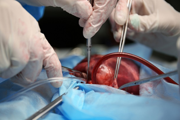 «Один донор спас четырех человек» - трансплантолог. Новости Днепра