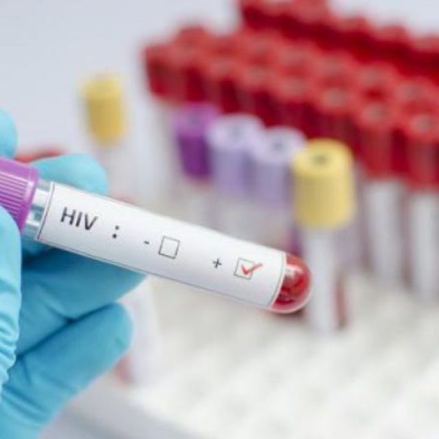 Где и когда можно пройти бесплатный тест на ВИЧ. Новости Днепра
