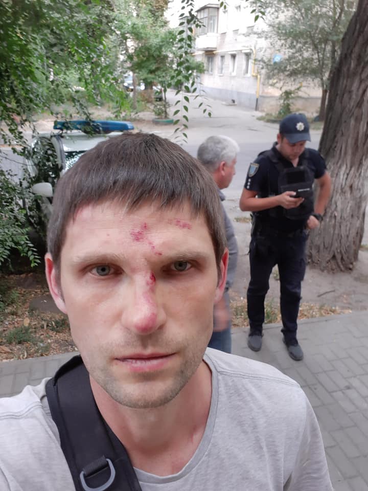 В Днепре избили активиста за улыбку. Новости Днепра