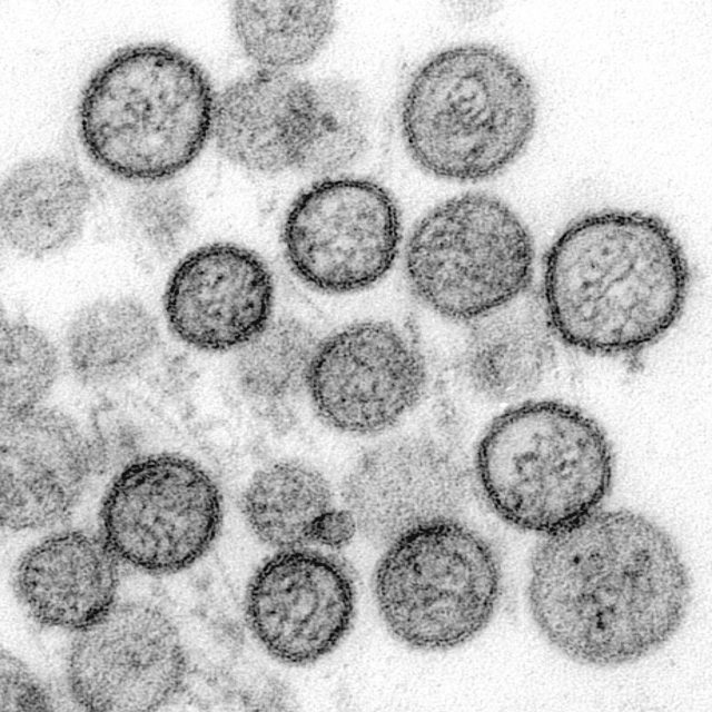 Хантавирус в Китае: почему от него погиб человек. Новости Днепра