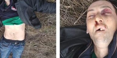 Полицейские Днепра просят опознать умершего возле «Озерки» мужчину