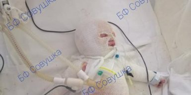 В Днепре спасают младенца с серьезными ожогами: фото