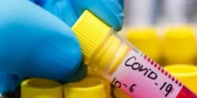 Коронавирус в Днепре: более десяти новых случаев