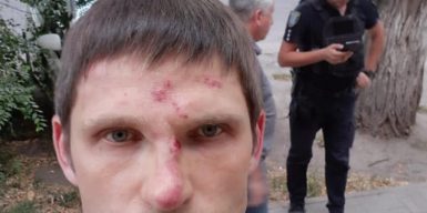 В Днепре избили активиста из-за улыбки: фото