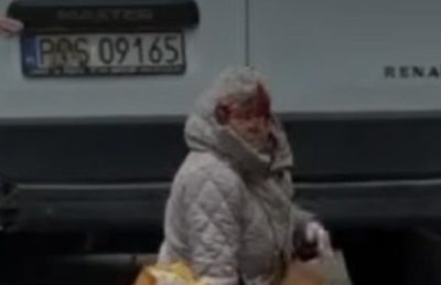 Представники ТЦК на авто збили пенсіонерку в Одесі: жінку у важкому стані забрала швидка