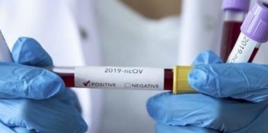 За сутки от коронавируса в Днепре выздоровели 40 человек, а заболели почти вдвое больше