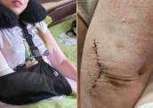 Адвокатка, яку побили у приміщенні ТЦК та СП у Харкові, отримала інвалідність