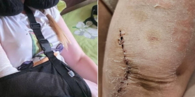 Адвокатка, яку побили у приміщенні ТЦК та СП у Харкові, отримала інвалідність