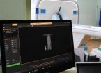 На Закарпатті судитимуть медичних посадовців за збитки у понад 4,8 млн грн під час закупівлі томографа