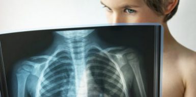В Україні розширюють можливості діагностики туберкульозу у дітей