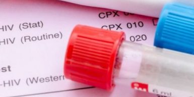 Днепряне могут получить бесплатный тест на ВИЧ и лечение